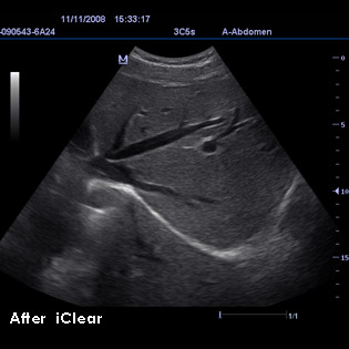 DC3-Diagnostic Ultrasound System