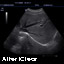 DC3-Diagnostic Ultrasound System