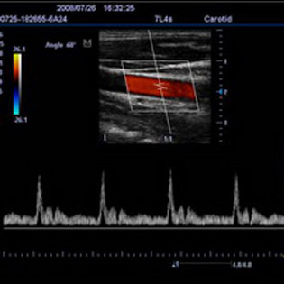 DC3-Diagnostic Ultrasound System