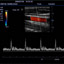 DC3-Diagnostic Ultrasound System