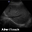 DC3-Diagnostic Ultrasound System