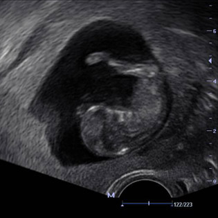 DC3-Diagnostic Ultrasound System