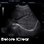 DC3-Diagnostic Ultrasound System