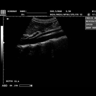 DP-990Plus-Diagnostic Ultrasound System