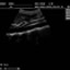 DP-990Plus-Diagnostic Ultrasound System