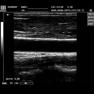 DP-990Plus-Diagnostic Ultrasound System