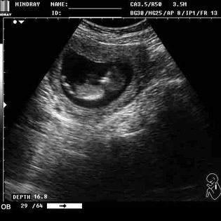 DP-990Plus-Diagnostic Ultrasound System