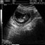 DP-990Plus-Diagnostic Ultrasound System