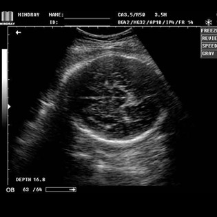 DP-990Plus-Diagnostic Ultrasound System