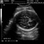 DP-990Plus-Diagnostic Ultrasound System