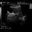 DP-990Plus-Diagnostic Ultrasound System