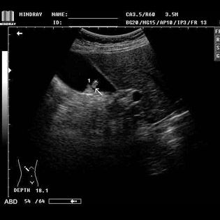 DP-990Plus-Diagnostic Ultrasound System
