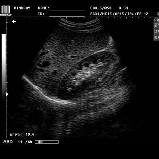DP-990Plus-Diagnostic Ultrasound System