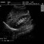 DP-990Plus-Diagnostic Ultrasound System