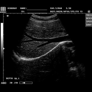 DP-990Plus-Diagnostic Ultrasound System