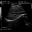 DP-990Plus-Diagnostic Ultrasound System