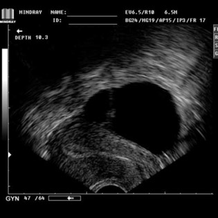 DP-990Plus-Diagnostic Ultrasound System