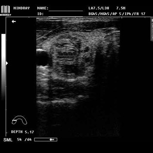 DP-990Plus-Diagnostic Ultrasound System