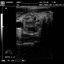 DP-990Plus-Diagnostic Ultrasound System