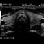 DP-990Plus-Diagnostic Ultrasound System