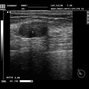 DP-990Plus-Diagnostic Ultrasound System