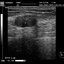DP-990Plus-Diagnostic Ultrasound System