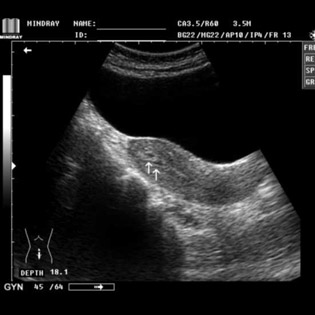 DP-990Plus-Diagnostic Ultrasound System