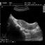 DP-990Plus-Diagnostic Ultrasound System