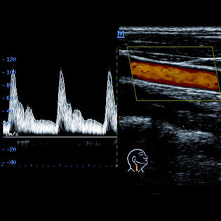 M5-Expert-Diagnostic Ultrasound System