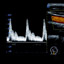 M5-Expert-Diagnostic Ultrasound System