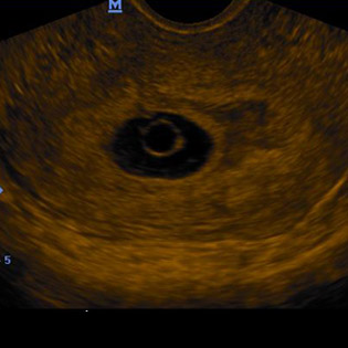M5-Expert-Diagnostic Ultrasound System
