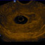 M5-Expert-Diagnostic Ultrasound System