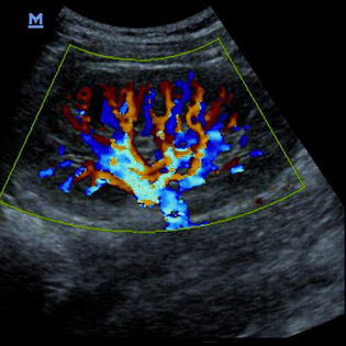 M5-Expert-Diagnostic Ultrasound System