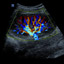 M5-Expert-Diagnostic Ultrasound System