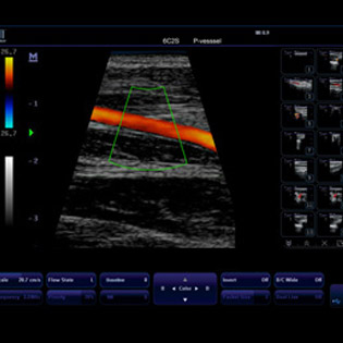 M5-Expert-Diagnostic Ultrasound System