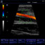 M5-Expert-Diagnostic Ultrasound System