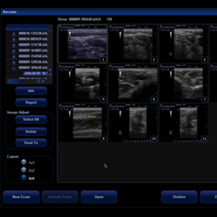 M5-Expert-Diagnostic Ultrasound System