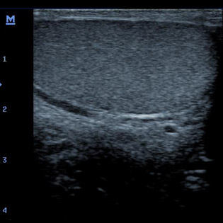 M5-Expert-Diagnostic Ultrasound System