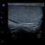 M5-Expert-Diagnostic Ultrasound System