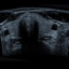 M5-Expert-Diagnostic Ultrasound System