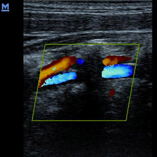 M5-Expert-Diagnostic Ultrasound System
